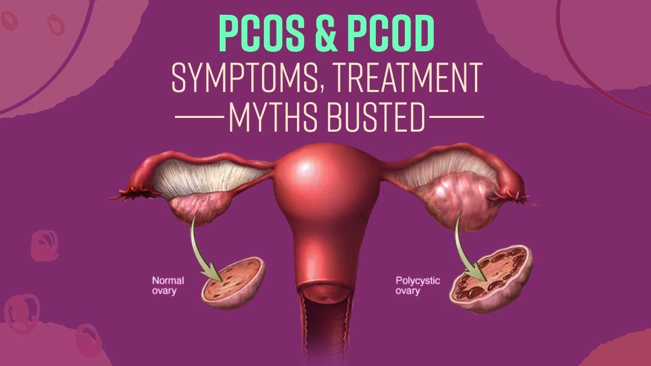 PCOS/PCOD Treatment