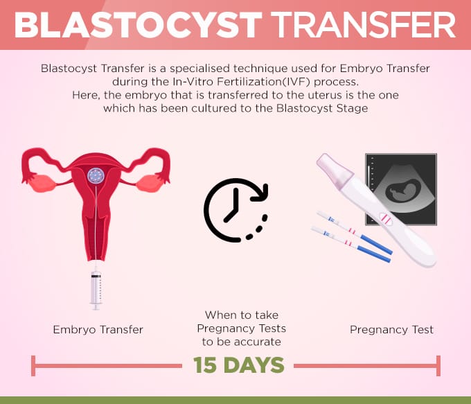 Blastocyst Transfer