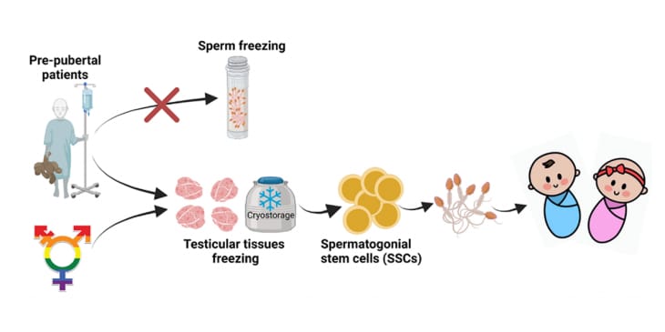 Egg/ Sperm/ Testicular Tissue/ Embryo Freezing