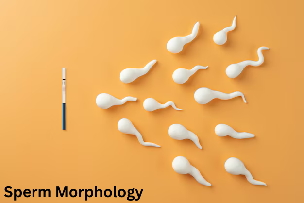 How to Read a Sperm Analysis Report?