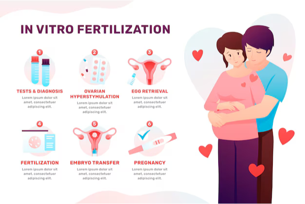In-vitro fertilization (IVF)