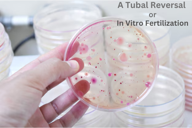 A Tubal Reversal Or In Vitro Fertilization?