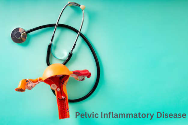 What is Pelvic Inflammatory Disease and how to Overcome it?