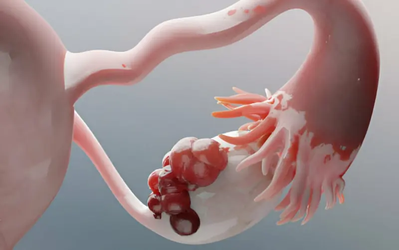 How Ovary Size Affects Egg Quality and Fertility