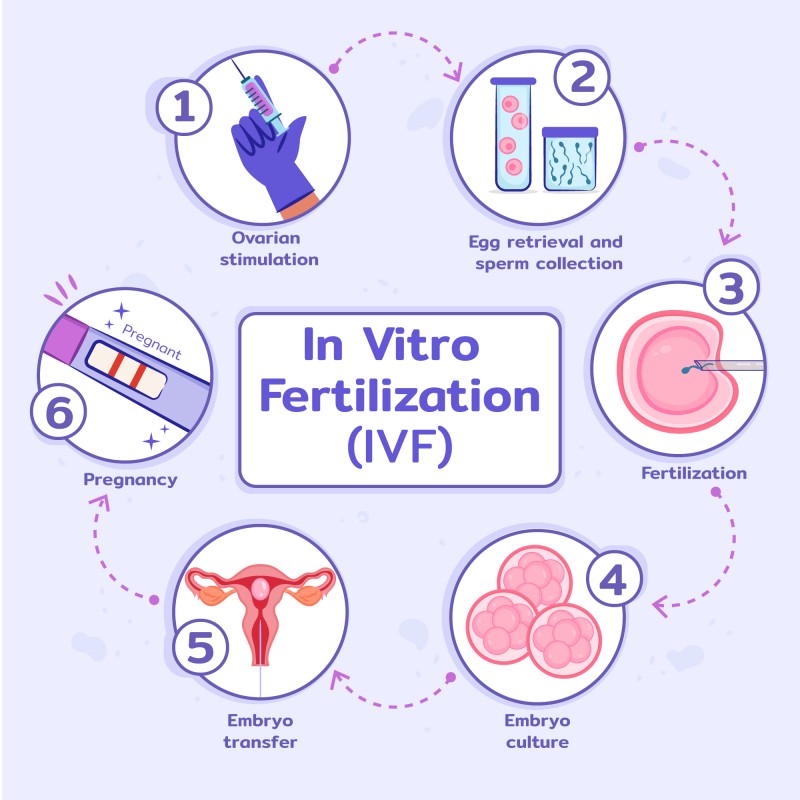 IVF Center का क्या मतलब होता है?