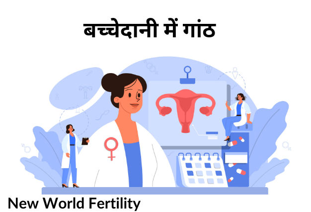 Uterine Fibroids (बच्चेदानी में गांठ): लक्षण, जाँच और सर्वश्रेष्ठ इलाज