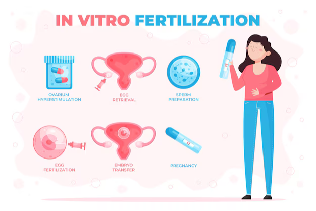 Step-by-Step Guide to IVF Treatment